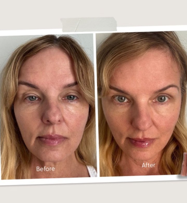 upneeq-eye-drops-review